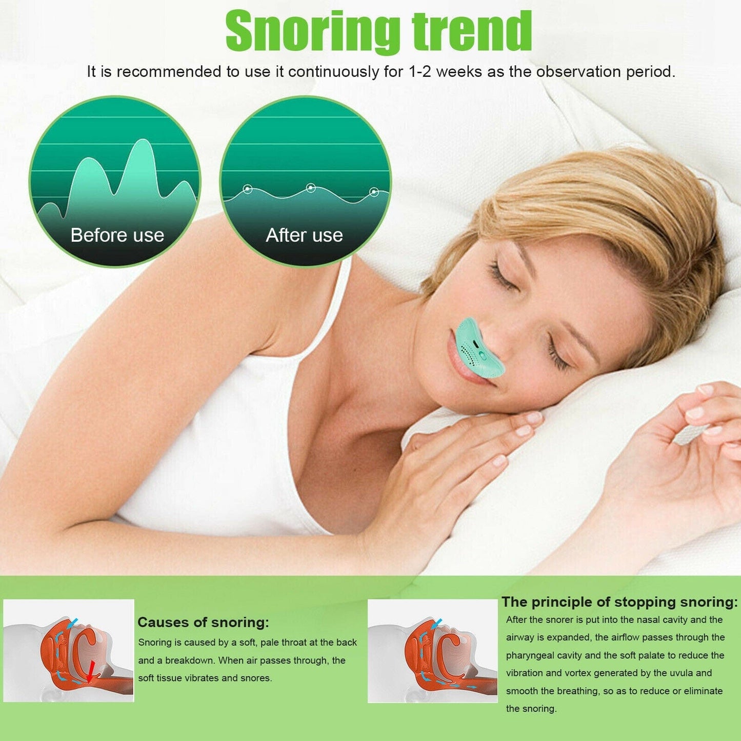APROLO™ Electric Mini Anti Snoring Device - flowerence