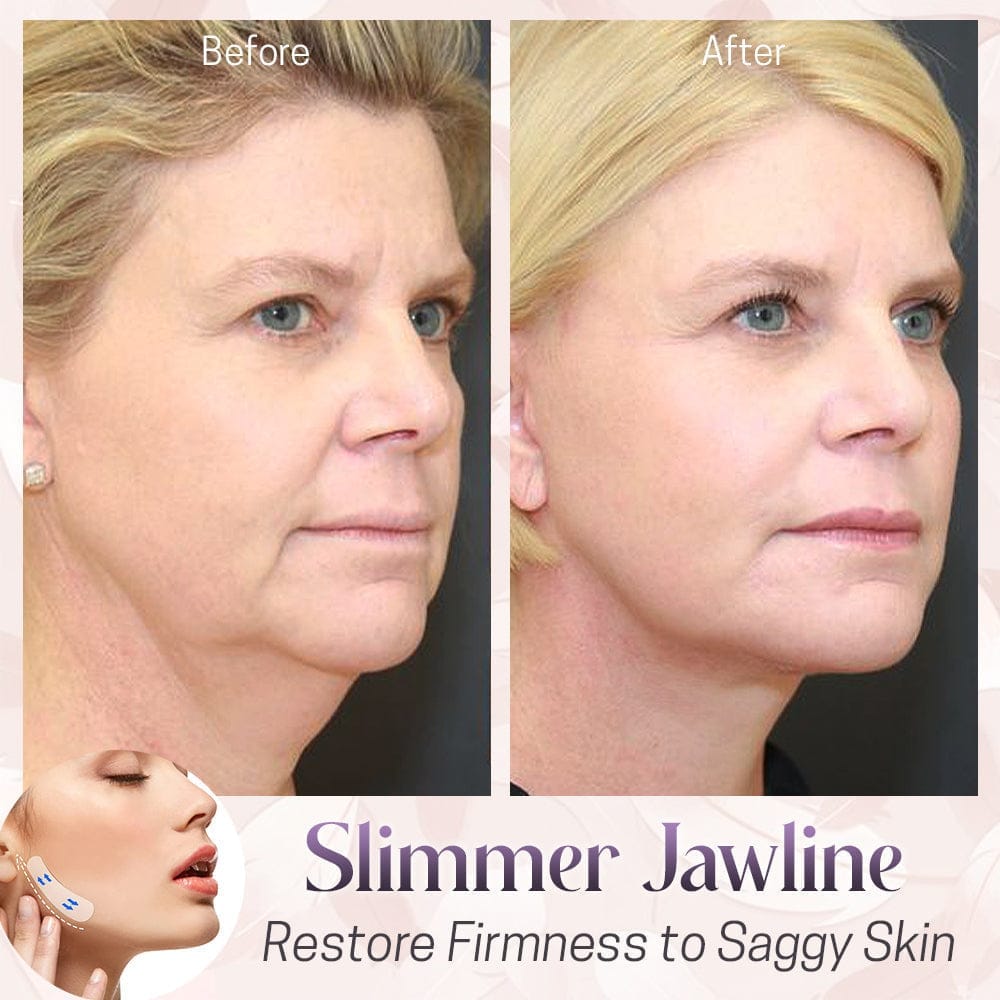 Powerful Invisible Face Liftening Tape Kit - flowerence