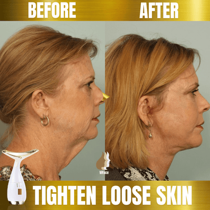 ViFace Ultrasonic Facial Lifting Massager - flowerence